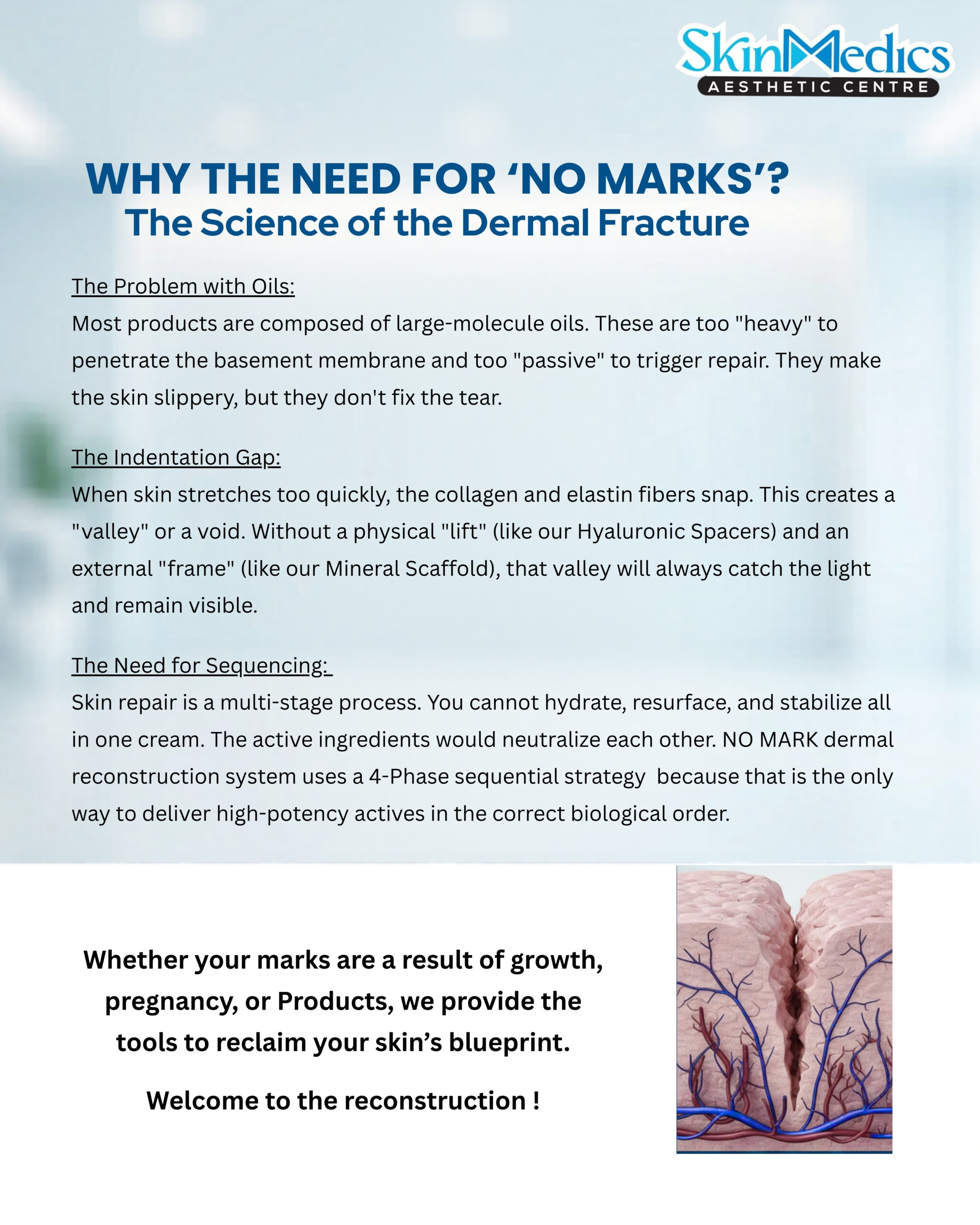 'NO MARKS' Dermal Reconstruction System(FULL SET) - Image 2